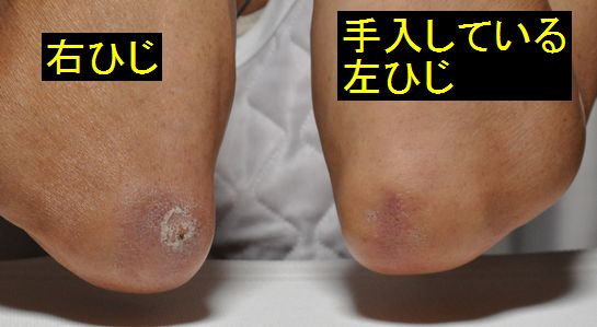 肘(ひじ)はこの通り