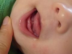 100824_teeth