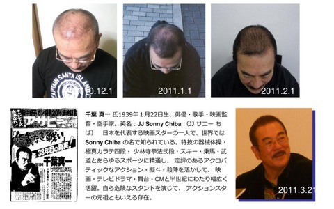 hair-gain-021-640x400