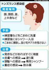 OSK200904090085