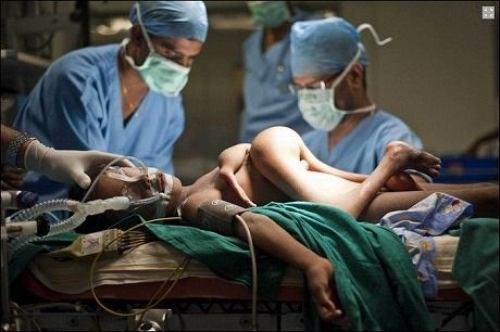 parasitic_twin_11