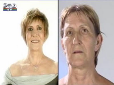 plastic_surgery_08