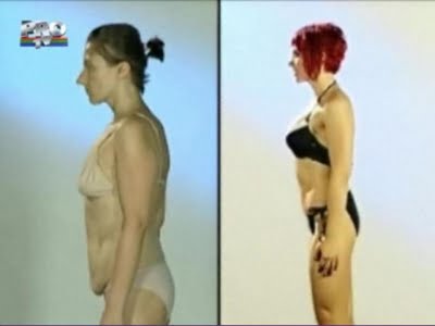 plastic_surgery_10