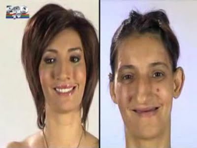 plastic_surgery_03