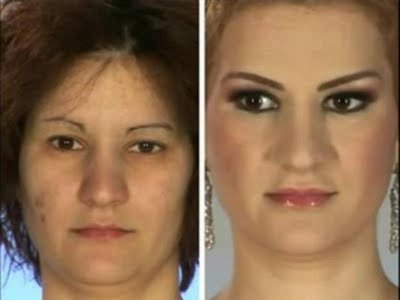 plastic_surgery_15