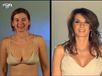 plastic_surgery_23