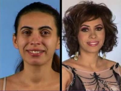 plastic_surgery_26