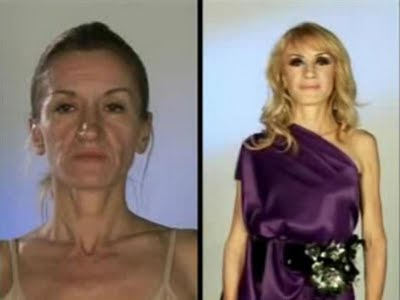 plastic_surgery_14