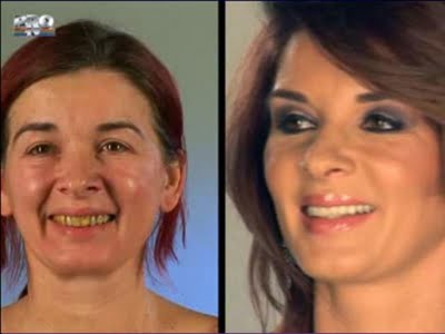 plastic_surgery_24