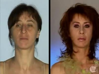 plastic_surgery_17