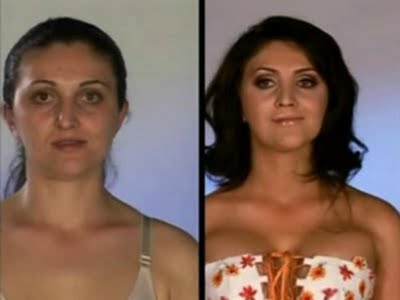 plastic_surgery_18