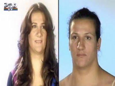plastic_surgery_07