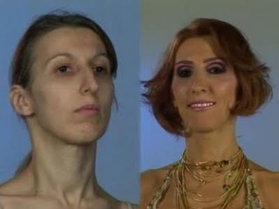 plastic_surgery_28