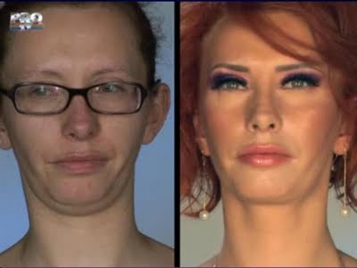 plastic_surgery_22