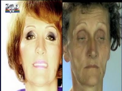 plastic_surgery_05