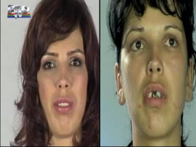 plastic_surgery_04