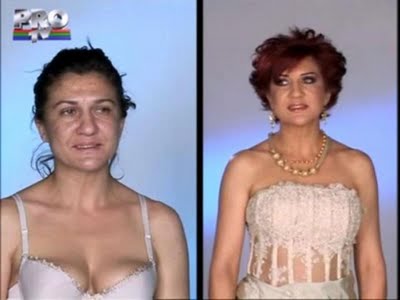 plastic_surgery_19