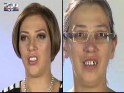 plastic_surgery_29