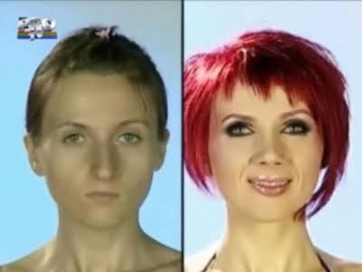 plastic_surgery_12