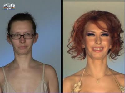 plastic_surgery_21