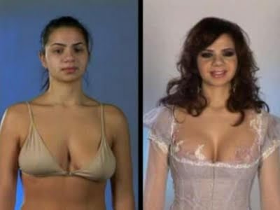 plastic_surgery_27