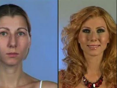 plastic_surgery_31
