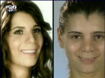 plastic_surgery_13