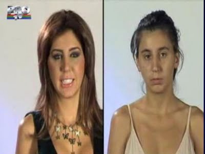 plastic_surgery_02