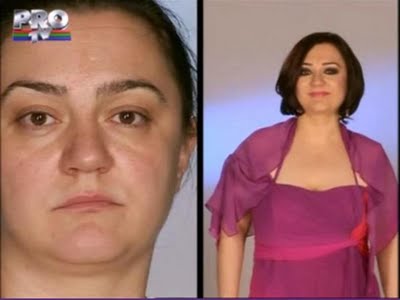 plastic_surgery_20
