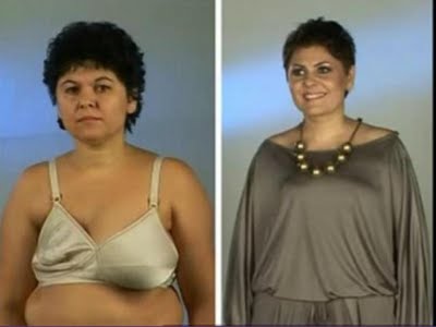plastic_surgery_16