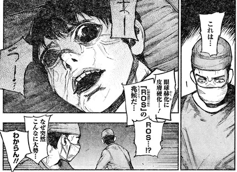 喰種化