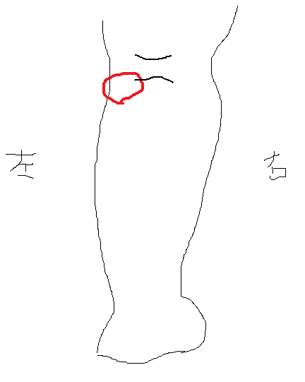 シンスプリント1