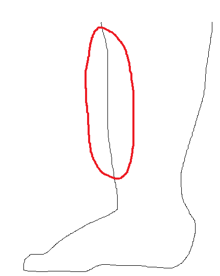シンスプリント9