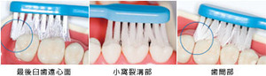 b10_ph02