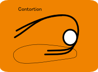 Contortion