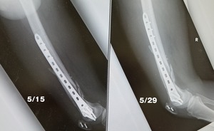 20170529_140631