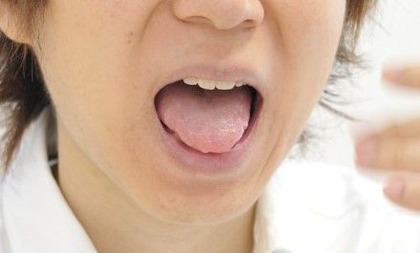 球麻痺
