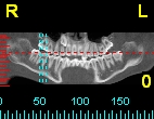 680-op