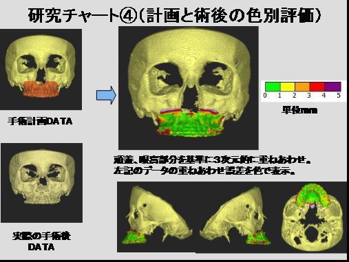 グラフィックス3