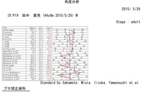 角度分析