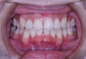 ６