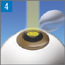 LASIK2