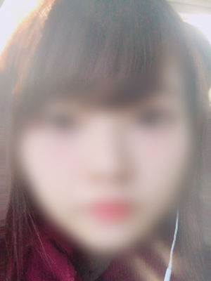 mio300-400