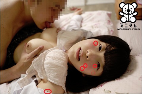 ren2