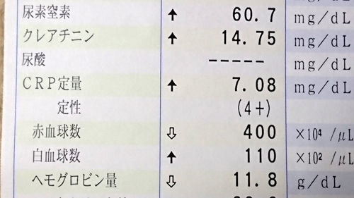 血液検査