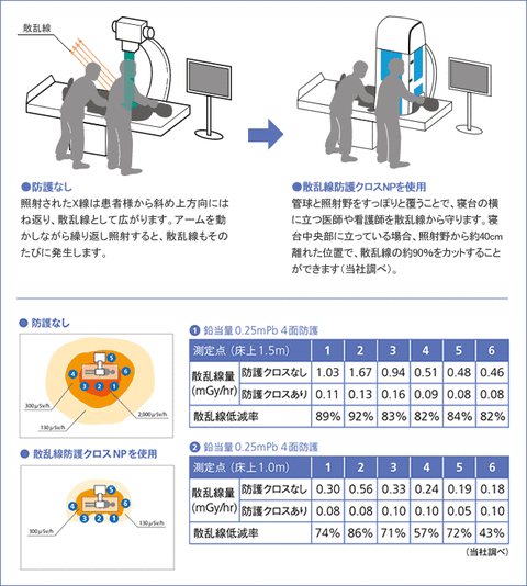 散乱放射線