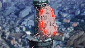 アローン