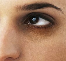 black-under-eyes