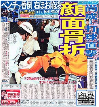 高橋尚成顔面骨折