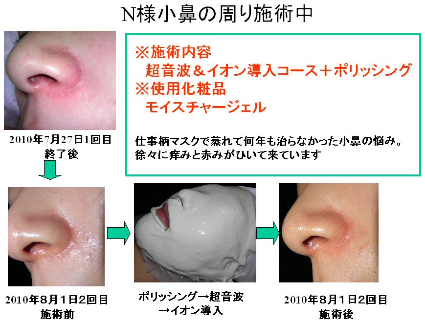 フェイシャルモニター Ryokoの日記